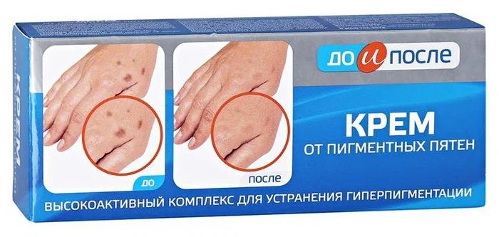 До и после крем от пигментации 50мл
